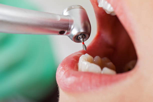Best Emergency Care for Gum Disease in Moraga, CA